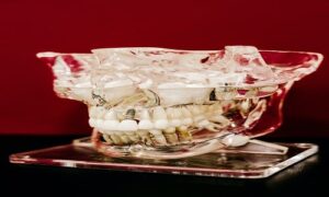 While we all try to maintain good oral health by brushing and oral health requires regular dental trips for professional dental cleanings,,,