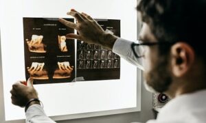Dental X-rays are often essential for children to find any problems buried below the gum line and beneath the enamel of the teeth.