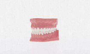 Consider the following tips for optimal gum health, including essential practices outlined in the guide on "how to maintain healthy gums."