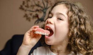 In this article, we will explore cases of abnormal tooth eruption, the role of braces in correction, and showcase before-and-after transformations of individuals who underwent orthodontic treatment.