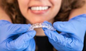 does invisalign make teeth yellow