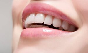 How to Have Beautiful Teeth