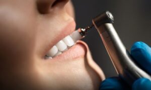 Regular Cleaning and Gum Disease