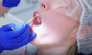 Benefits of Fluoride Treatments