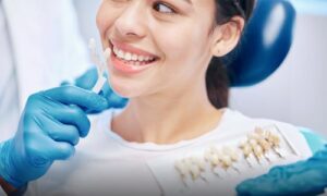 benefits of dental veneers