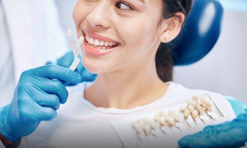 benefits of dental veneers