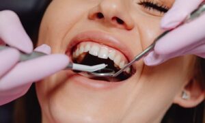 dental implant procedure steps