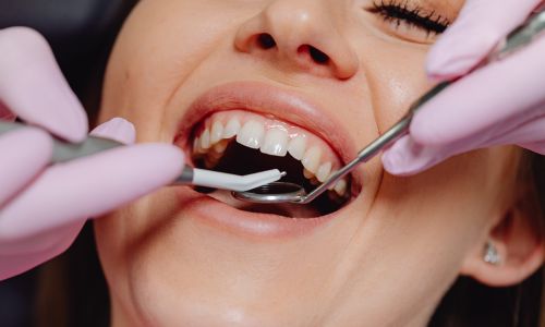dental implant procedure steps