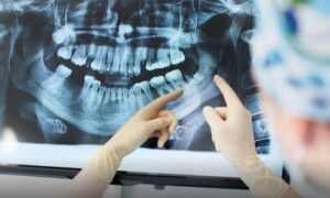 modern dentistry X-rays