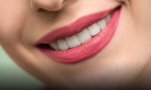 perfect smile benefits health